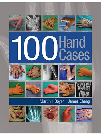 100 Hand Cases
