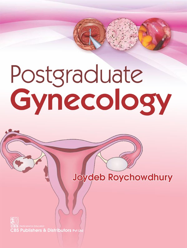 Postgraduate Gynecology (Pb 2017)