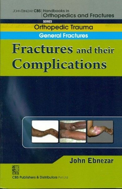 Fractures And Their Complications (Handbook In Orthopedics And Fractures Vol 3 Orthopedic Trauma General Fractures (2012)
