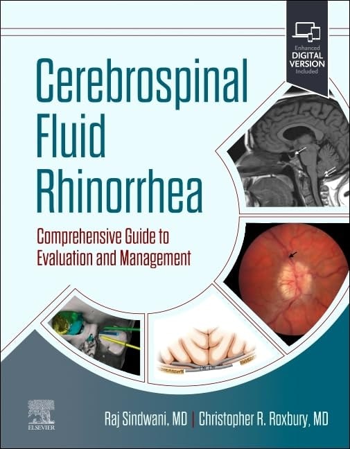 Cerebrospinal Fluid Rhinorrhea Comprehensive Guide To Evaluation And Management With Access Code (Hb 2024)