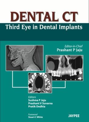 Dental Ct Third Eye In Dental Implants