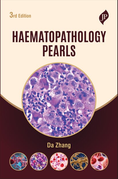 HAEMATOPATHOLOGY PEARLS
