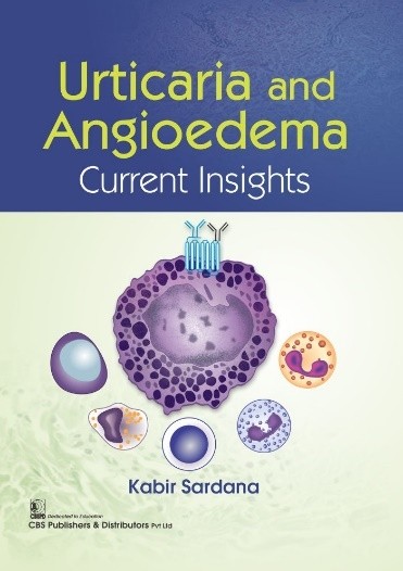 Urticaria And Angioedema Current Insights (Pb 2022)