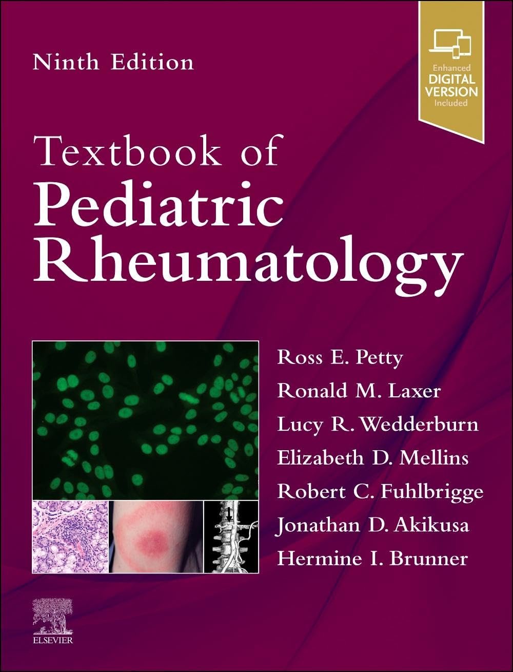 Textbook Of Pediatric Rheumatology 9Ed (Hb 2026)