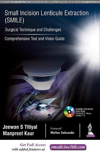 SMALL INCISION LENTICULE EXTRACTION (SMILE) SURGICAL TECHNIQUE AND CHALLENGES:COMPREHENSIVE TEXT