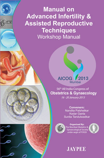 Manual On Advanced Infertility & Assisted Reproductive Techniques Workshop Manual Aicog 2013