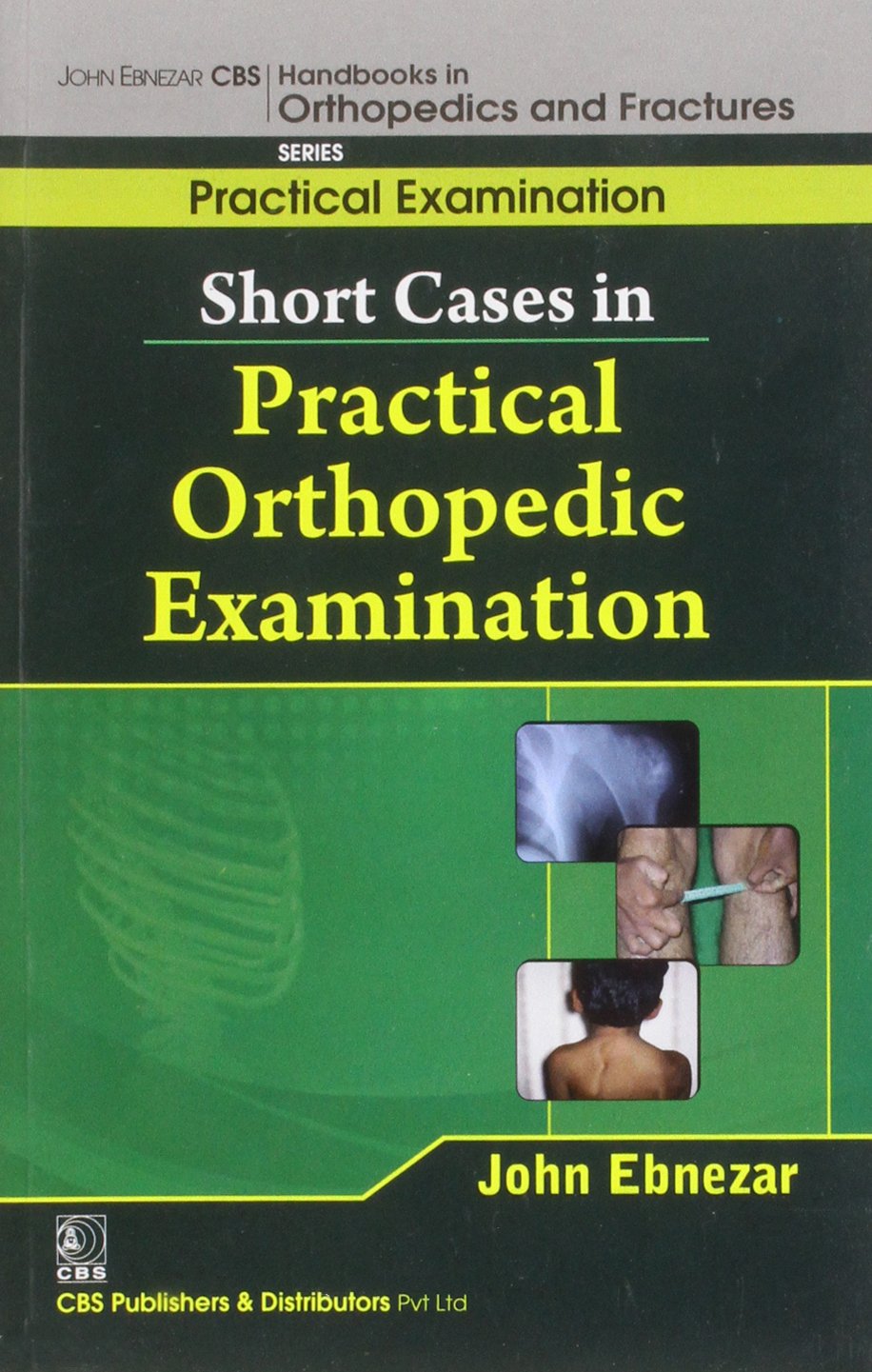 Short Cases In Practical Orthopedic Examination (Handbooks In Orthopedics And Fractures Series Vol 64 Practical Examination (2012)