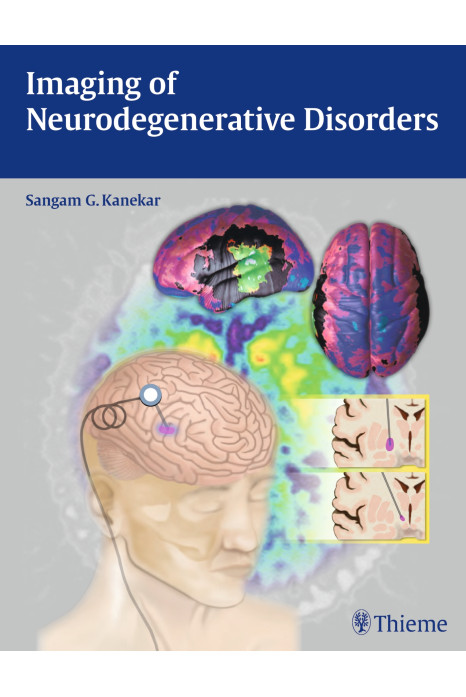 Imaging Of Neurodegenerative Disorders