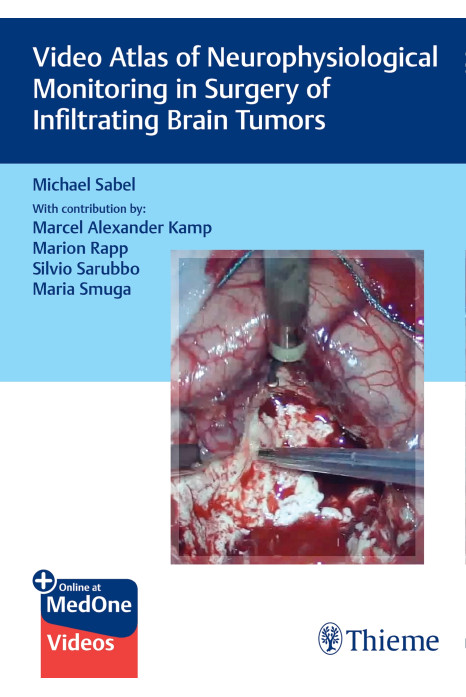 Video Atlas of Neurophysiological Monitoring in Surgery of Infiltrating Brain Tumors 1st Edition 2022