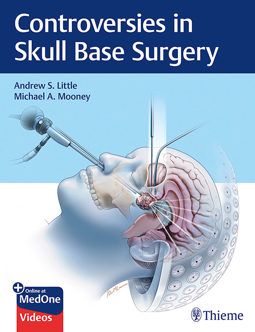 Controversies in Skull Base Surgery 1st Edition 2019