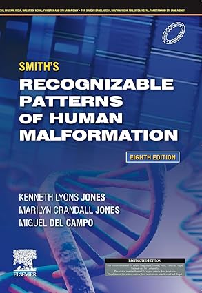 Smith's recognizable patterns of human malformation: expert consult - online and print,8e