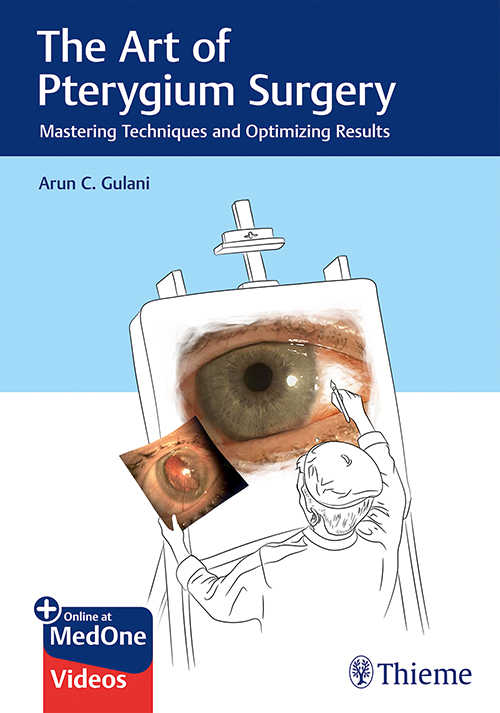 The Art Of Pterygium Surgery Mastering Techniques And Optimizing Results