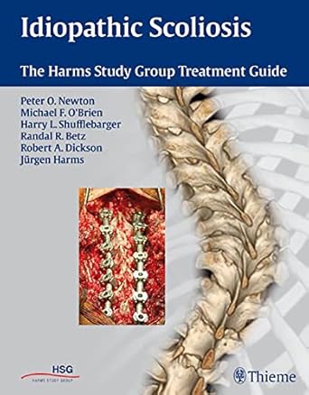 Idiopathic Scoliosis 1st Edition 2011