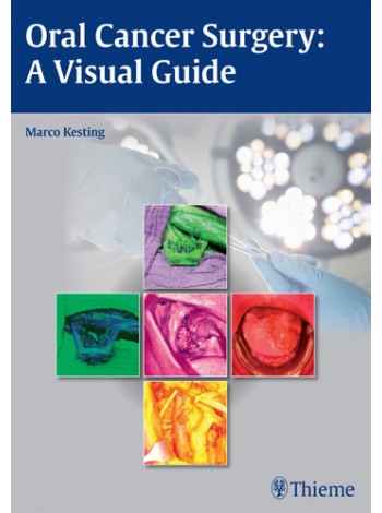 Oral Cancer Surgery A Visual Guide (Hb 2015)