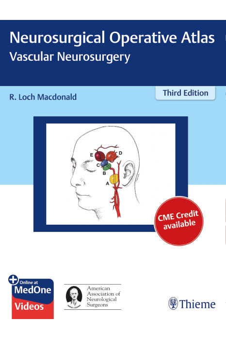 Neurosurgical Operative Atlas Spine And Peripheral Nerves