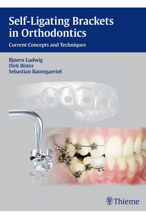 Cover of SELF LIGATING BRACKETS IN ORTHODONTICS 1st Edition 2012