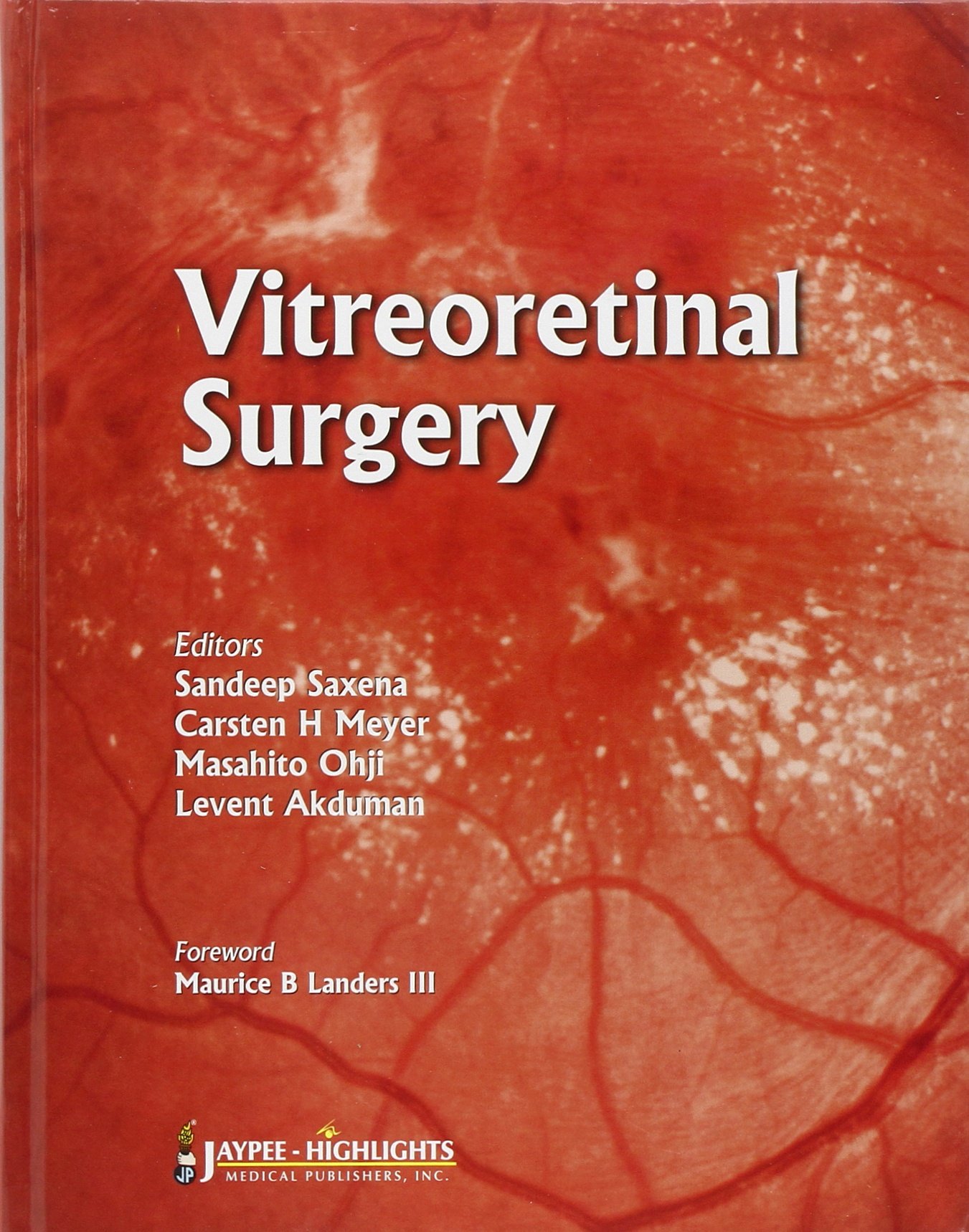 Vitreoretinal Surgery