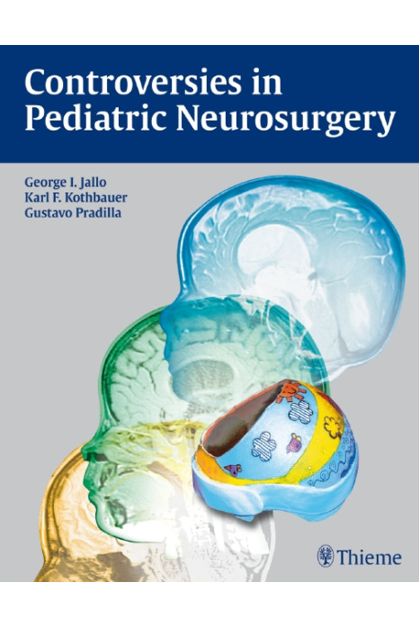 Controversies In Pediatric Neurosurgery (Hb 2011)