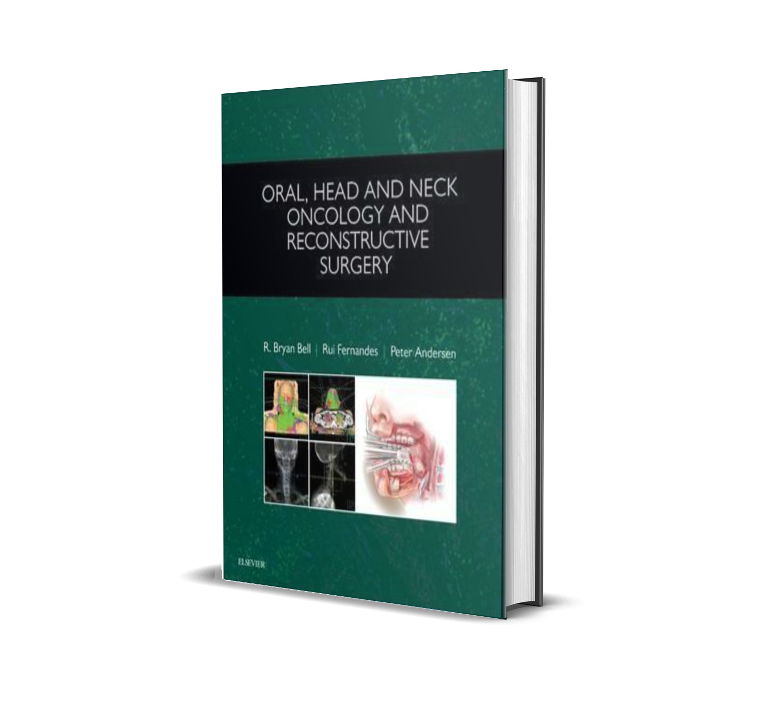 Oral, Head and Neck Oncology and Reconstructive Surgery -1E