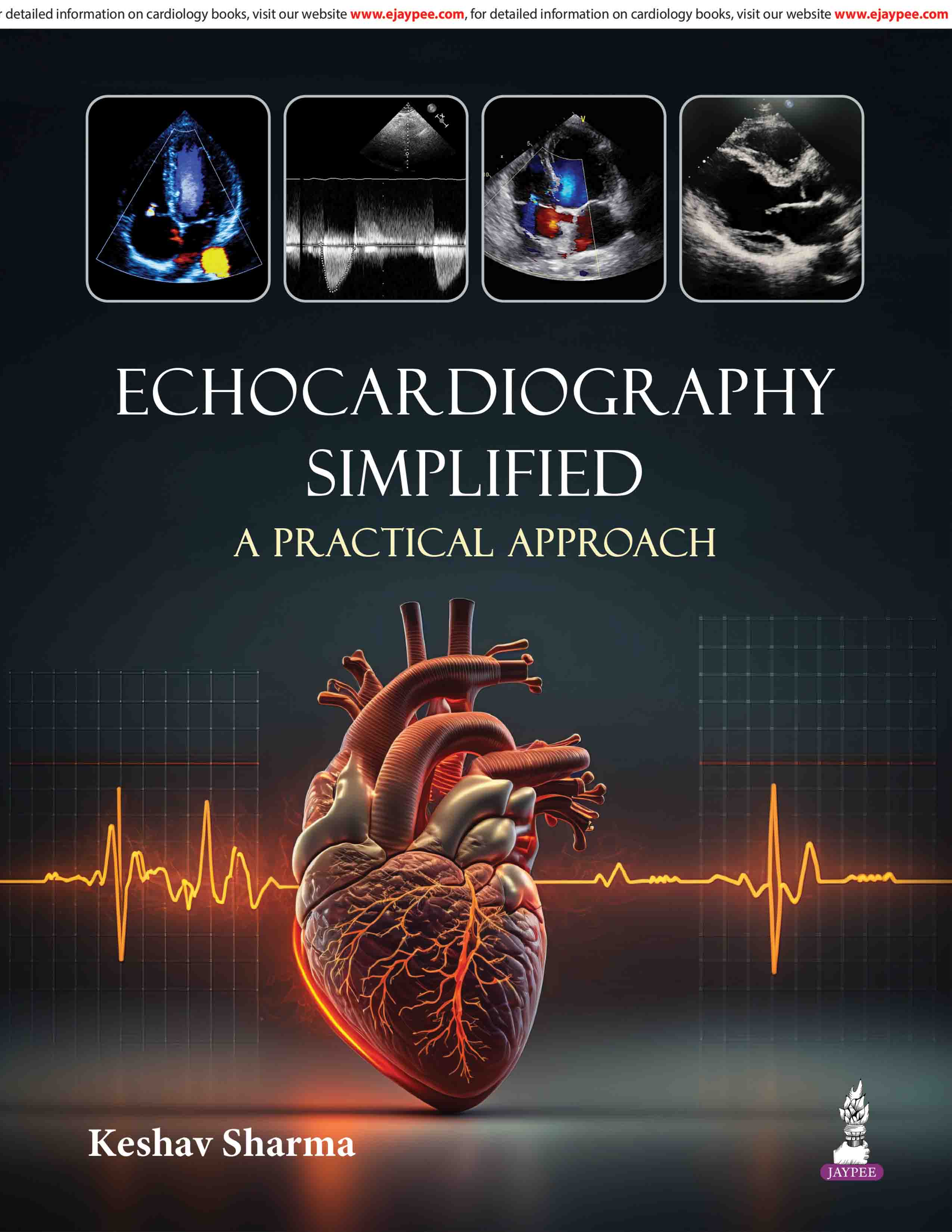 ECHOCARDIOGRAPHY SIMPLIFIED A PRACTICAL APPROACH