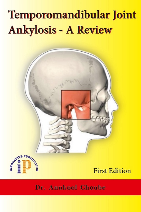 Temporomandibular Joint Ankylosis – A Review