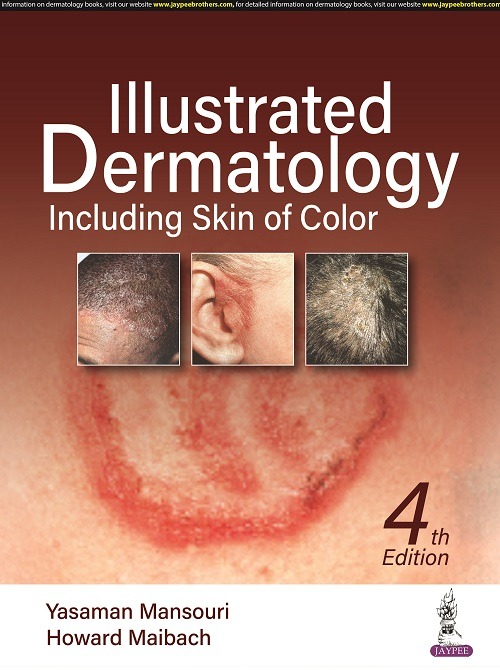 Illustrated Dermatology Including Skin Of Color