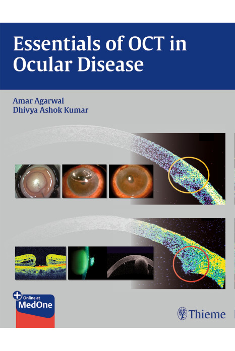 Essentials Of Oct In Ocular Disease (Hb 2015)