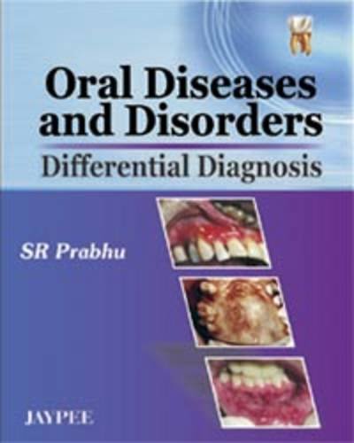 Cover of Oral Diseases And Disorders Differential Diagnosis