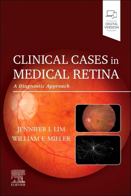 Clinical Cases In Medical Retina A Diagnostic Approach With Access Code (Pb 2025)