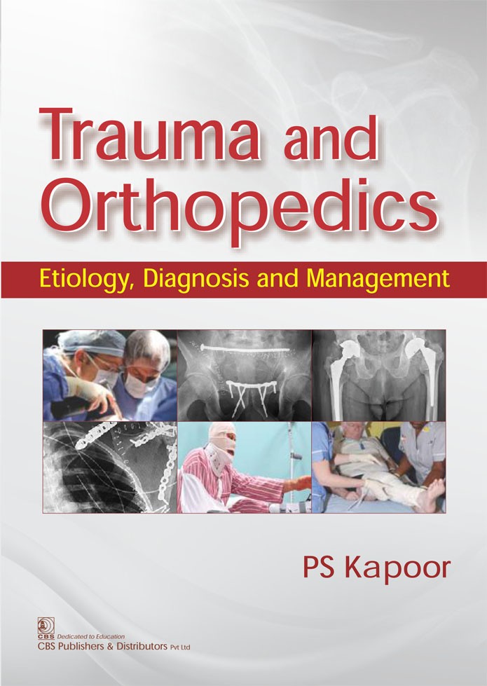 Trauma And Orthopedics Etiology Diagnosis And Management (Pb 2017)