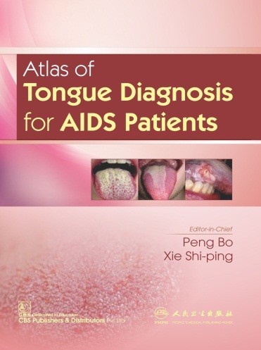 Cover of Atlas Of Tongue Diagnosis For AIDS Patients (CBS Reprint)