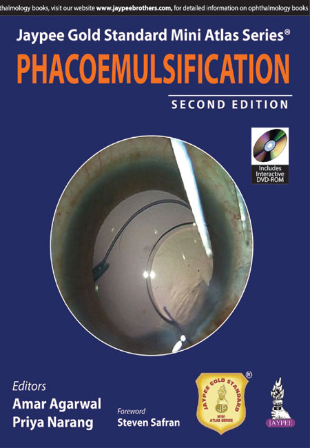 Jaypee Gold Standard Mini Atlas Series Phacoemulsification With Dvd-Rom