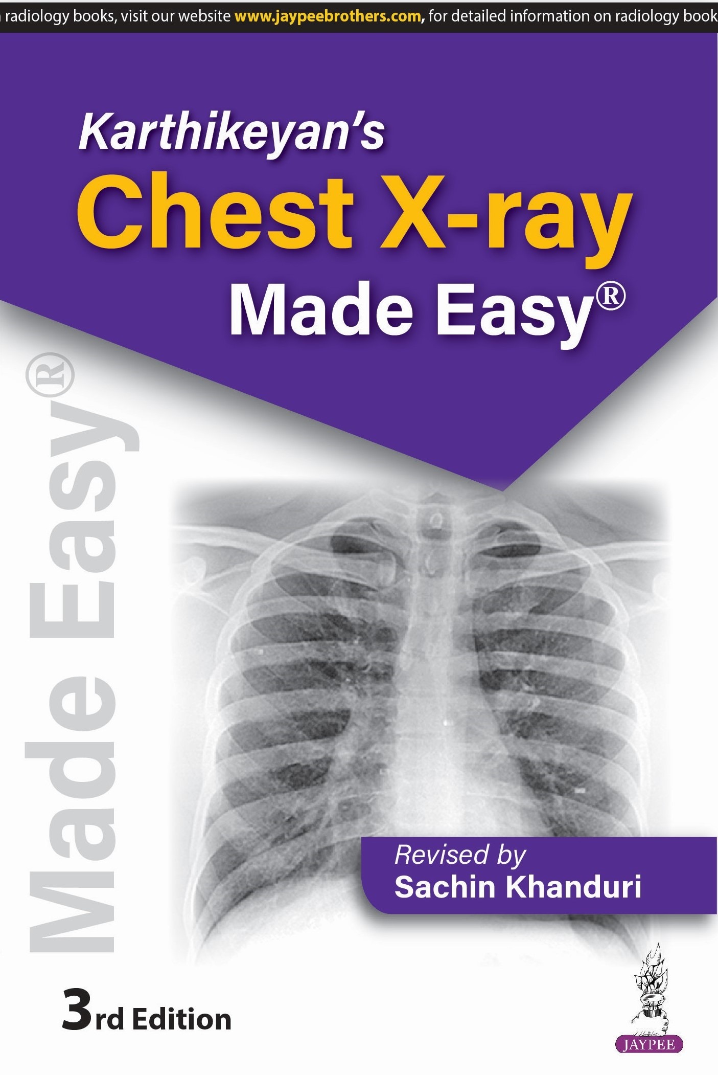 KARTHIKEYAN'S CHEST X-RAY MADE EASY