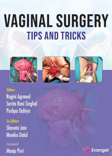 Vaginal Surgery Tips And Tricks