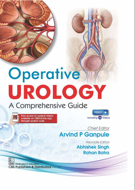 Operative Urology A Comprehensive Guide (Hb 2025)