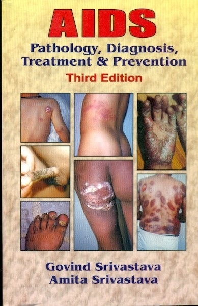 Aids Pathology Diagnosis Treatment And Prevention 3RD EDITION 2012