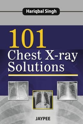 101 Chest Xray Solutions