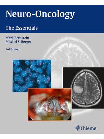 Neuro-Oncology: The Essentials: 3/e