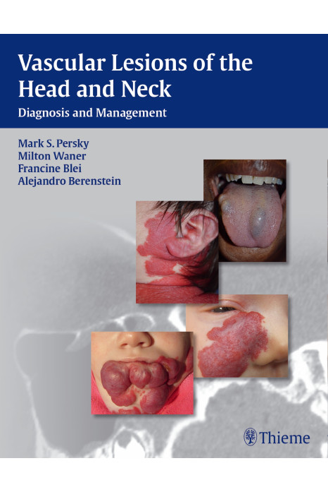 Vascular Lesions of the Head and Neck 1st Edition 2015
