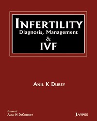 Infertility Diagnosis, Management & Ivf