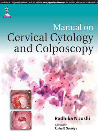 Manual On Cervical Cytology And Colposcopy