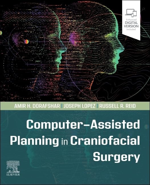 Computer assisted planning in craniofacial surgery with access code (pb 2024)