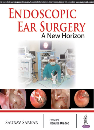 Endoscopic Ear Surgery A New Horizon