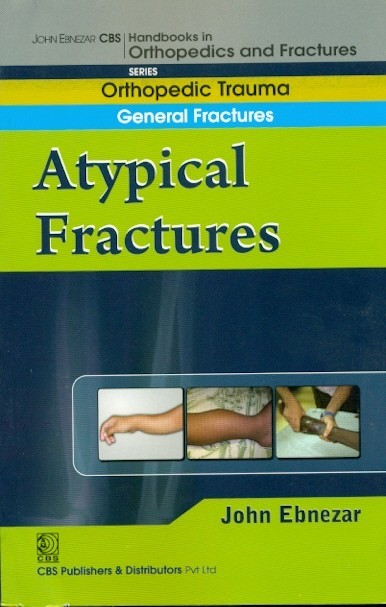 A Typical Fractures (Handbook In Orthopedics And Fractures Vol 4 Orthopedic Trauma General Fractures (2012)