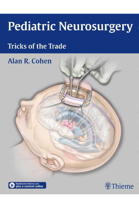 Pediatric Neurosurgery Tricks Of The Trade