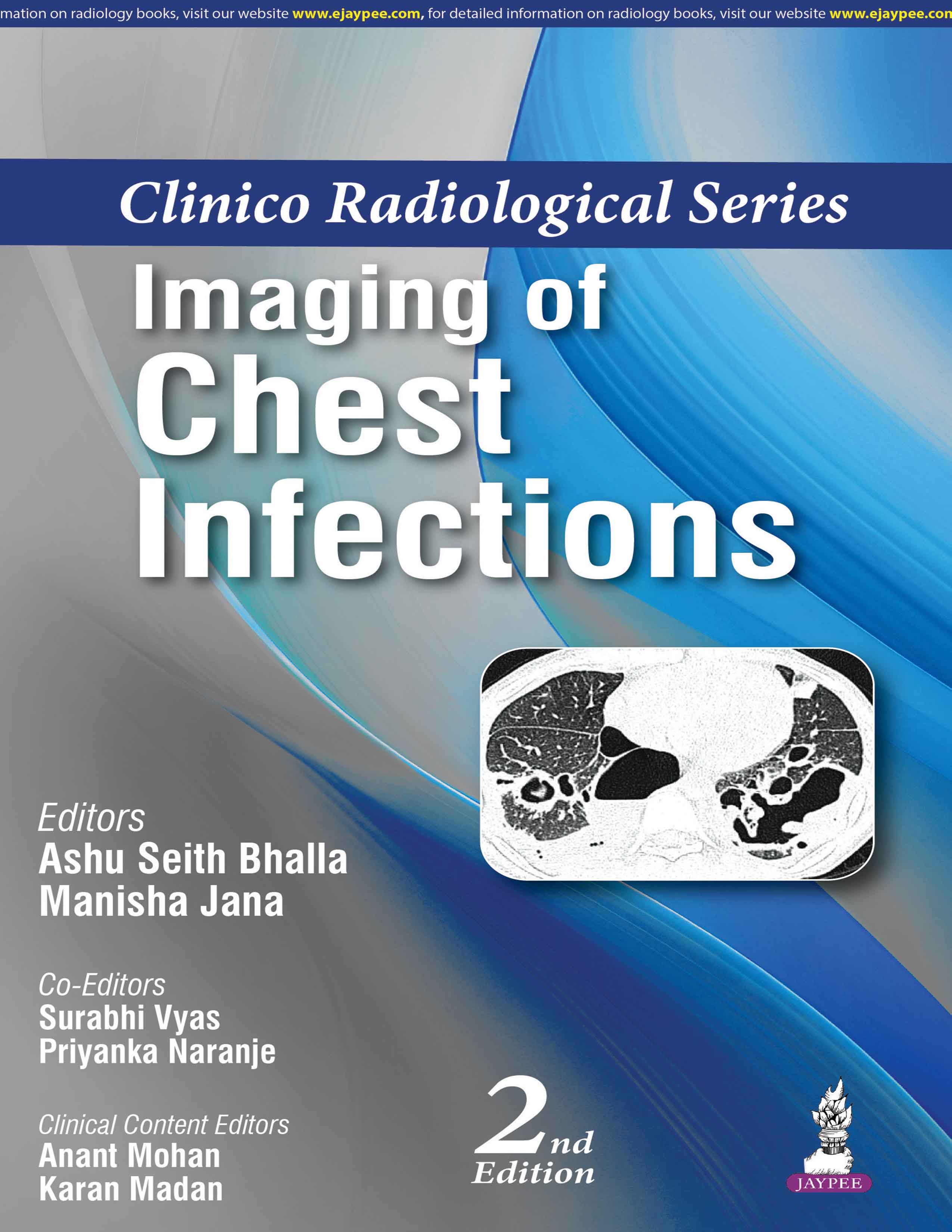 CLINICO RADIOLOGICAL SERIES IMAGING OF CHEST INFECTIONS