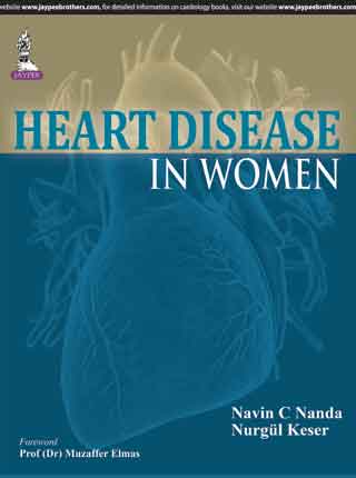 HEART DISEASE IN WOMEN