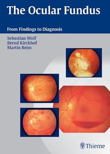 Nph - Normal Pressure Hydrocephalus Pathophysiology - Diagnosis - Treatment