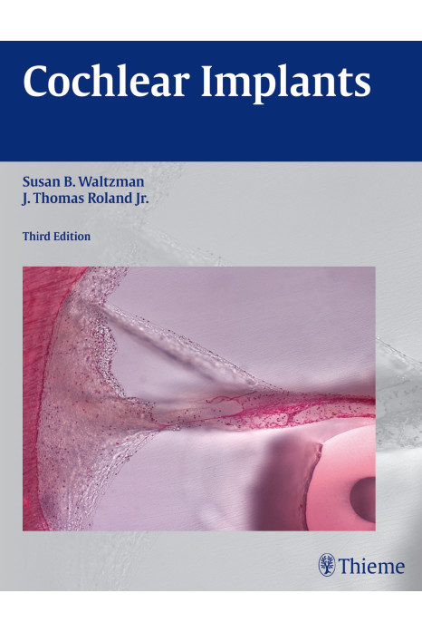 Cochlear Implants