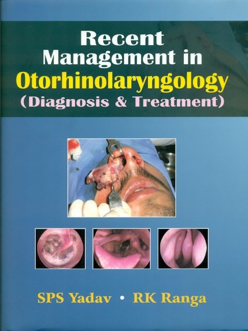 Recent Management In Otorhinolaryngology: Diagnosis & Treatment (Hb)